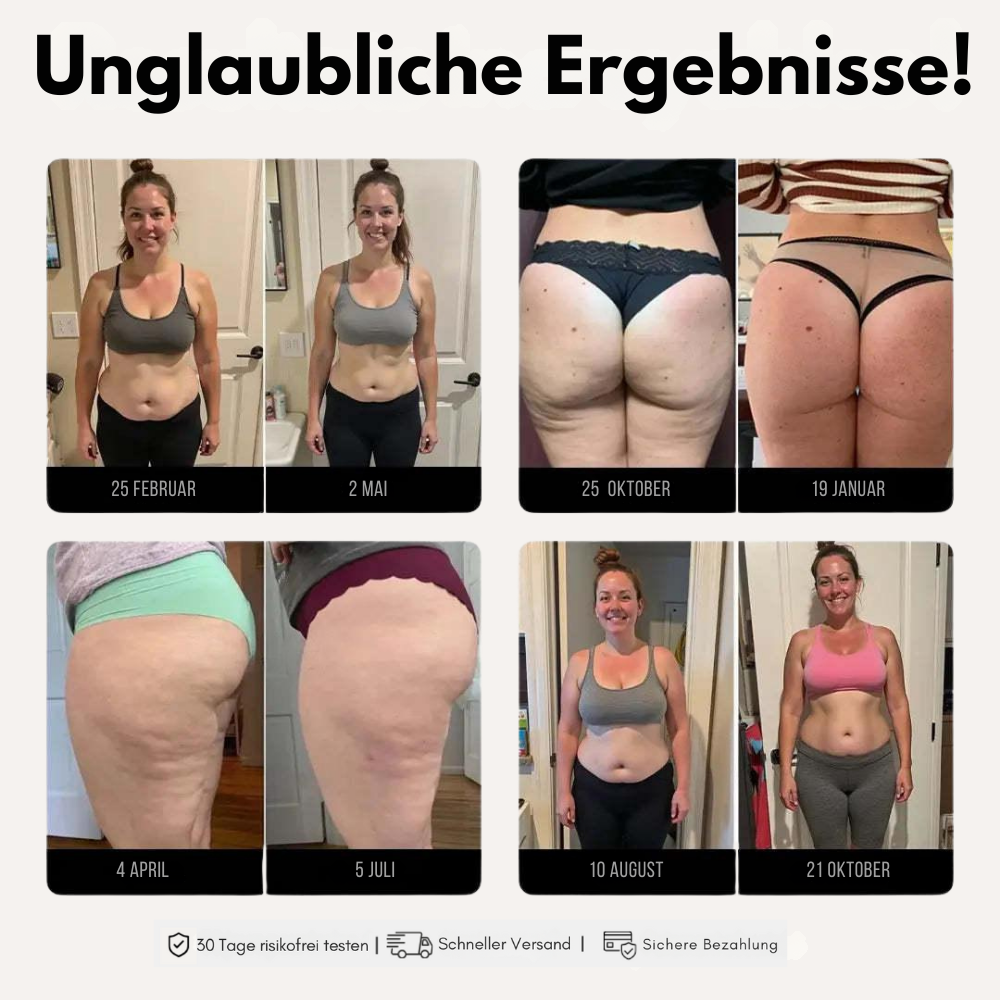 Leggings 3D Soleny® – Formender & Anti-Cellulite-Effekt